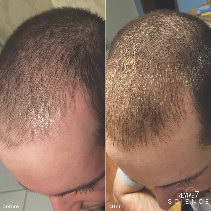 Revive7- Hair conditioning treatment