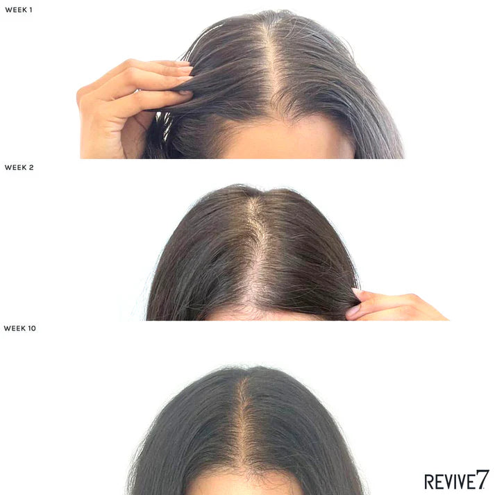 Revive7- Traitement revitalisant pour les cheveux 30ml